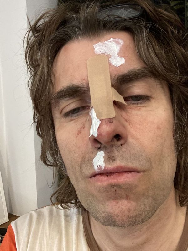 Liam Gallagher se cayó de un helicóptero: “Tengo la foto de portada para el próximo álbum” - Música - ABC Color