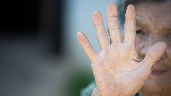 Diario HOY | Alzheimer, el tipo de demencia más conocido