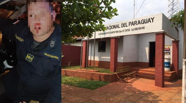 Atacaron a policías tras detener a un hombre que había golpeado a su mujer – Prensa 5