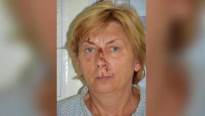 Misterio en Croacia: hallan en una isla a una mujer lastimada que no recuerda su nombre ni cómo llegó allí