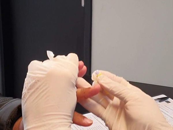 Juventud sigue siendo la franja etaria más expuesta y vulnerable a la trasmisión del VIH, recuerdan - Nacionales - ABC Color