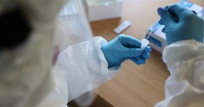 La Nación / Científicos descubren virus similar al del COVID-19 en murciélagos de Laos