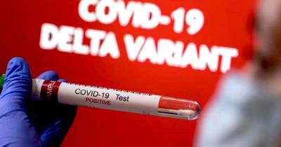 La Nación / Detectan 70 nuevos casos y un fallecido de la variante Delta