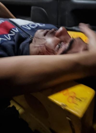 Gresca entre adictos dejó un herido en el barrio San Blas
