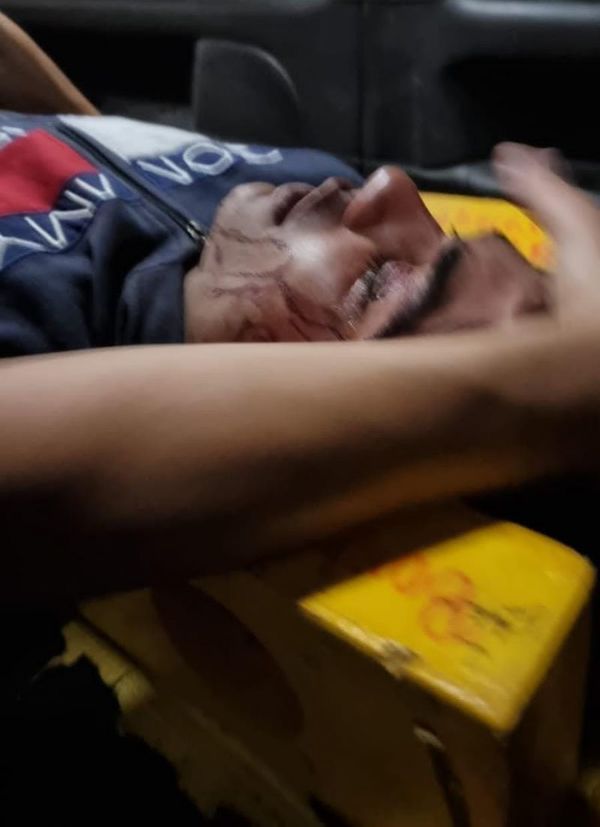 Gresca entre adictos dejó un herido en el barrio San Blas