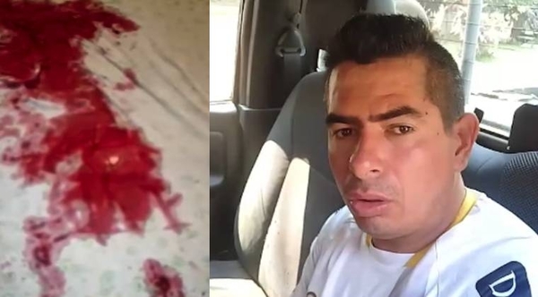 Diario HOY | Hombre apuñaló a hermanos de su expareja en Ciudad del Este