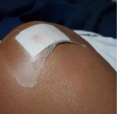 Joven fue brutalmente herida durante un asalto en la Costanera de Asunción | Ñanduti