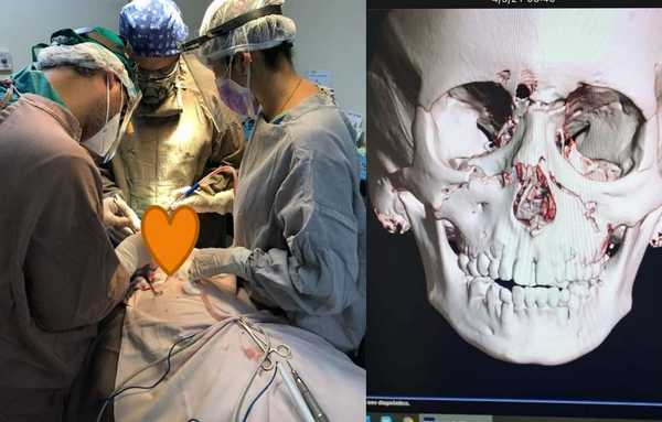 Reconstruyen el rostro de un niño de 9 años - Noticiero Paraguay
