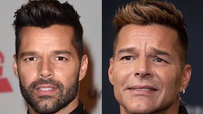 "Nueva" cara de Ricky Martin desata asombro y memes