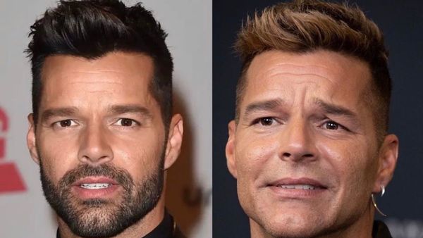 "Nueva" cara de Ricky Martin desata asombro y memes