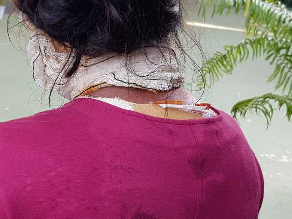 Mujer celosa derrama agua caliente a una joven por escribir con su novio - La Clave