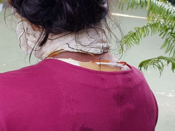 Mujer celosa derrama agua caliente a una joven por escribir con su novio