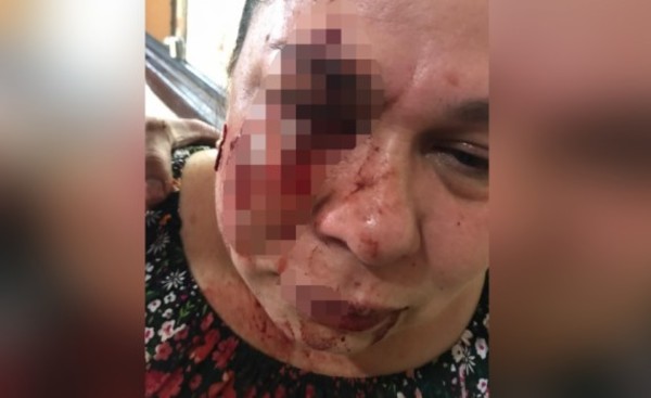 Mujer recibe brutal golpiza por reclamar hurto de gallina