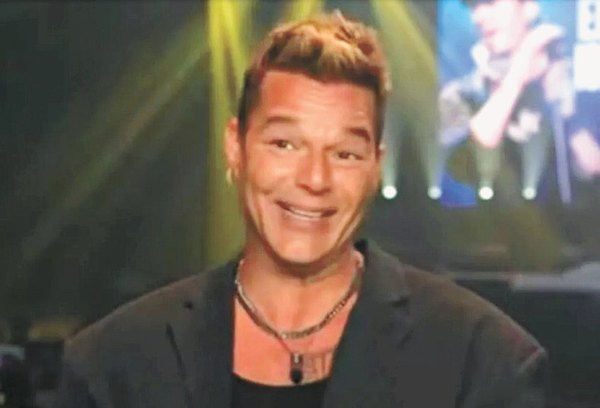 Crónica / RICKY MARTIN... ¿Qué se hizo en la cara?