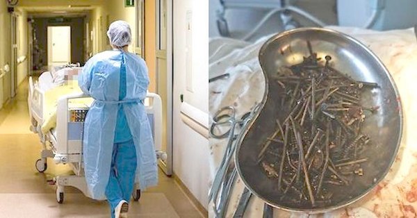 Crónica / Karai “ferretería” tenía 1 kilo de clavos en la panza