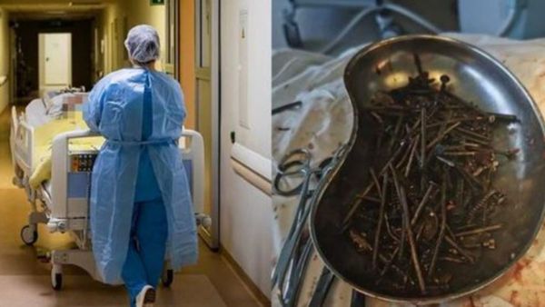 Médicos lituanos hallan un kilo de clavos y tornillos en estómago de paciente
