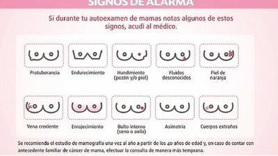 Señales de alarma y mitos a tener en cuenta sobre cáncer de mamas