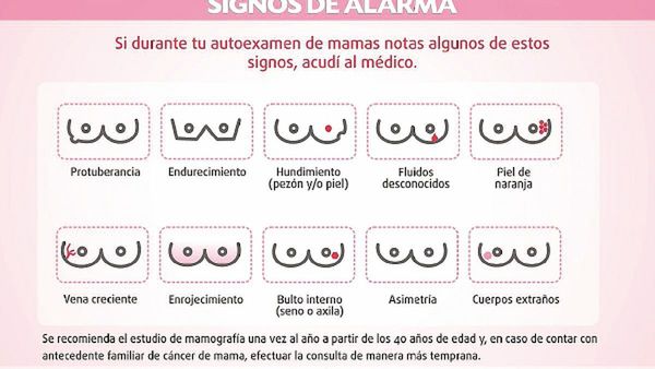 Señales de alarma y mitos a tener en cuenta sobre cáncer de mamas