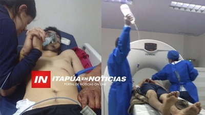 DESTROZÓ SU ROSTRO EN ACCIDENTE Y NECESITA AYUDA.