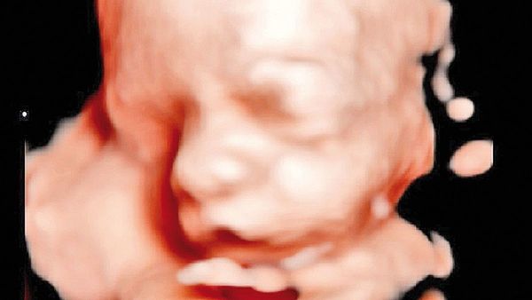 Se inicia campaña solidaria Dale Candela