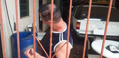 Macumbero asegura que "amuleto antibalas" le salvó del disparo de motochorros