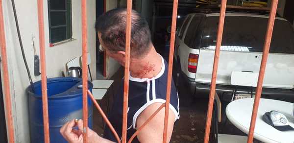 Macumbero asegura que "amuleto antibalas" le salvó del disparo de motochorros
