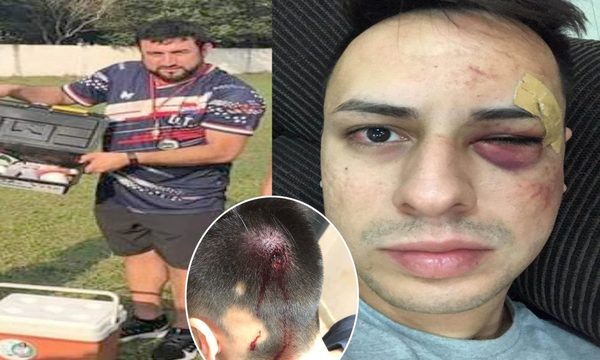 Político planillero agrede brutalmente a un joven, tras accidente de tránsito – Diario TNPRESS