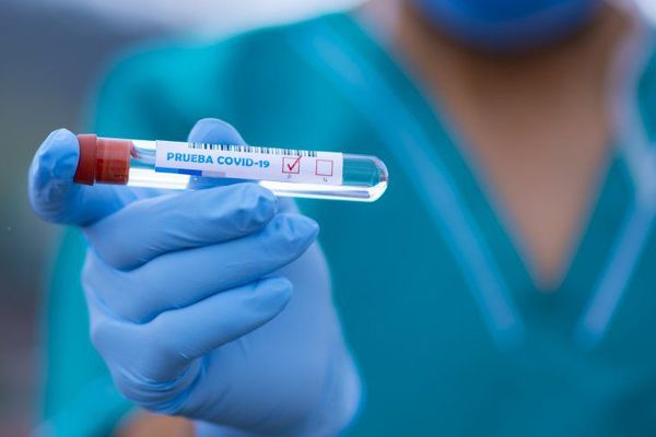 Covid a nivel local: ligero aumento de nuevos contagiados, sobre todo entre no vacunados, advierten - ADN Digital