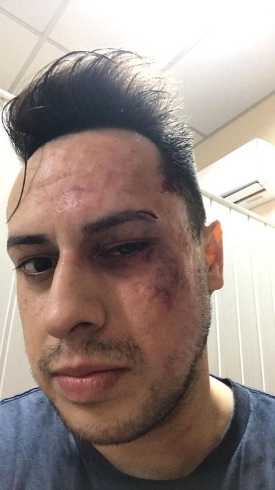 Joven denuncia que fue brutalmente golpeado por dirigente político - ABC en el Este - ABC Color