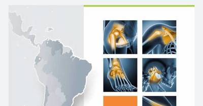 La Nación / Presentan Libro Blanco acerca de la osteoartritis