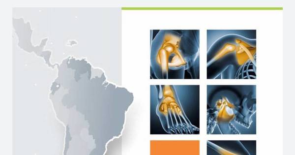 La Nación / Presentan Libro Blanco acerca de la osteoartritis