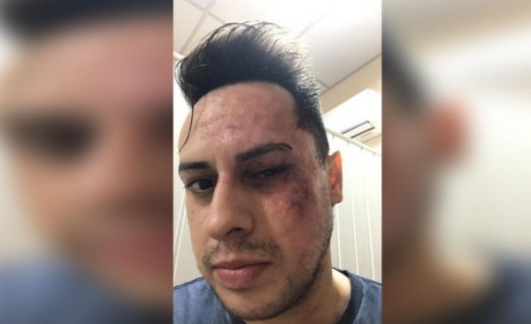 Supuesto dirigente liberal denunciado por salvaje agresión a un joven