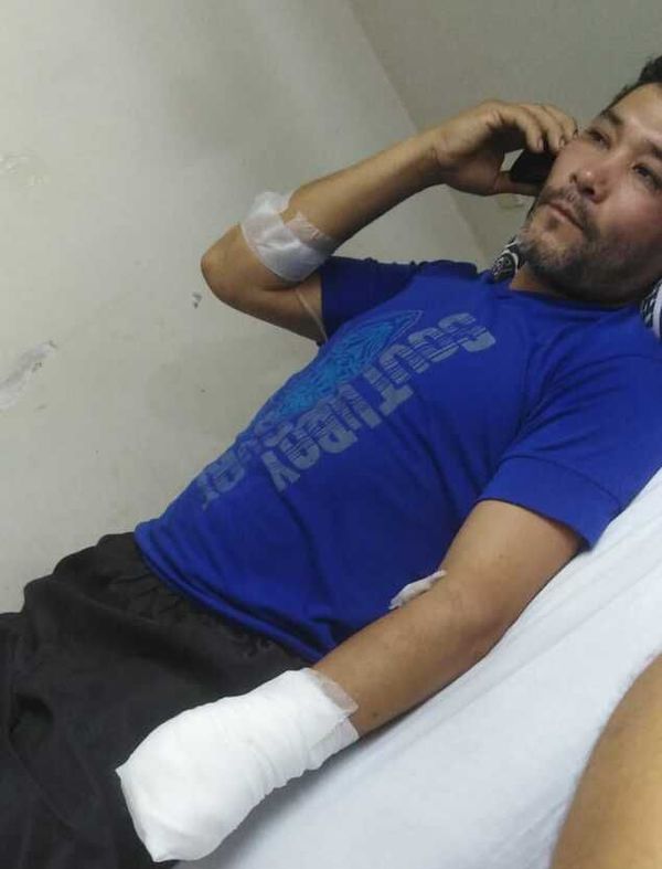 Cercenan la mano de un hombre tras pelea durante festejo electoral - Nacionales - ABC Color