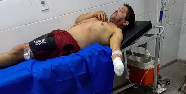Le cortaron la mano a un hombre, tras pelea durante festejo electoral - Noticiero Paraguay