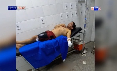 Hombre pierde una mano durante pelea en Areguá