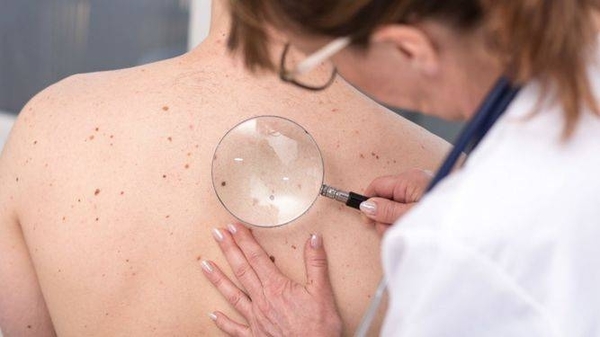 Diario HOY | Lanzarán campaña de prevención de cáncer de piel con evaluaciones a pacientes