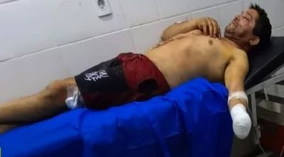 Hombre perdió la mano tras ser atacado a machetazos por un vecino en Areguá