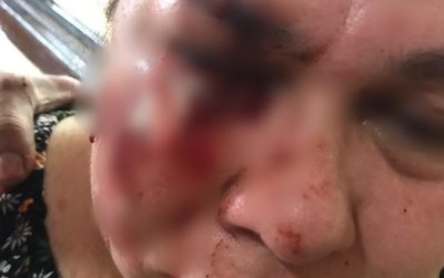 Imputan a hombre que molió a palo a su vecina
