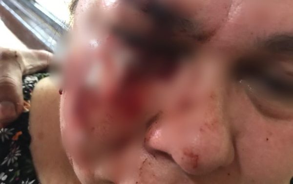 Imputan a hombre que molió a palo a su vecina