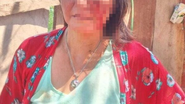 Desfiguró y molió a golpes a su hermana por un terreno
