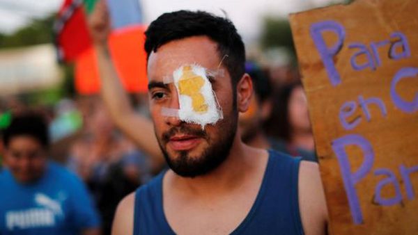 Revocan prisión preventiva para el expolicía chileno que dejó ciego a joven