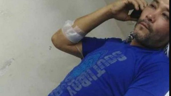 Le cortaron la mano tras festejo político