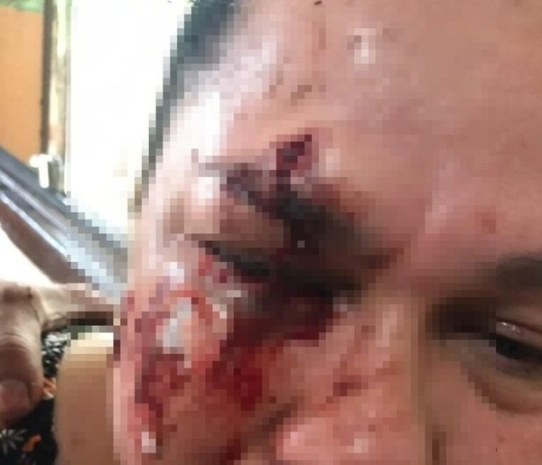 En Presidente Franco piden prisión para sujeto que desfiguró a golpes a su vecina - La Clave