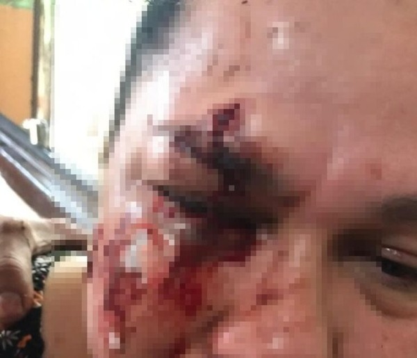 En Presidente Franco piden prisión para sujeto que desfiguró a golpes a su vecina - La Clave