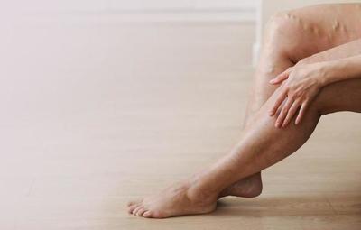Recuerdan por el “Día Mundial de la Trombosis”, que todo se puede prevenir a tiempo