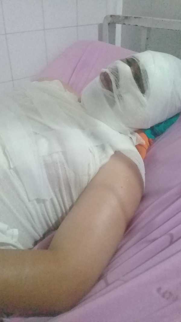 Sufrió quemaduras en el rostro por pedirle a su vecino que bajara el volumen de su música, ocurrió en Encarnación