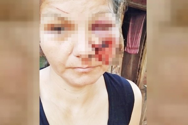 Crónica / ¿Fue garroteada por su hermano por terrenos?