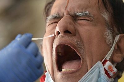 Cierran un laboratorio británico tras unos 43.000 tests de covid erróneos - Mundo - ABC Color