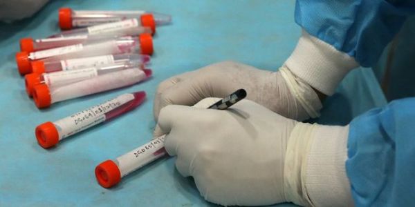 Clausuraron un laboratorio británico que hizo 43 mil pruebas de COVID-19 erróneas