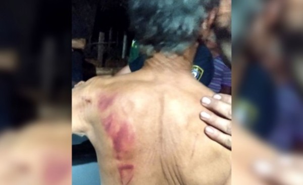 Quemaron con plancha y machetearon a abuelo para robarle G 140.000.000
